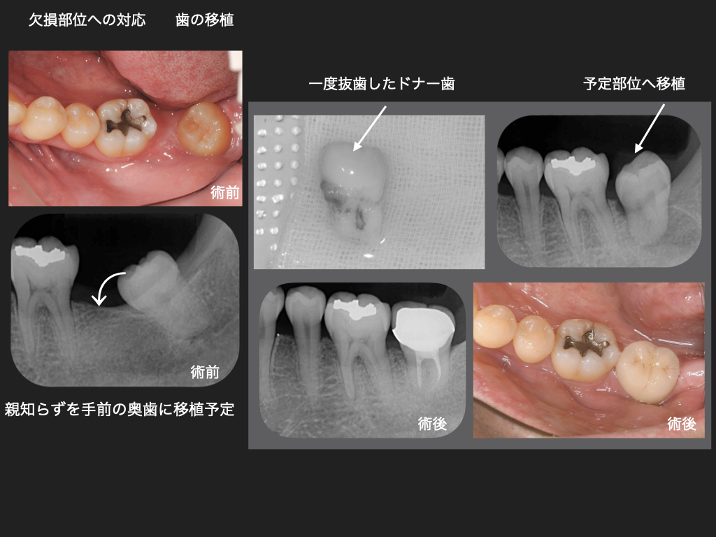 症例1